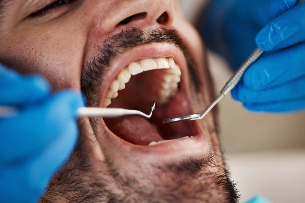 Best Emergency Dentist for Lost Fillings or Crowns in Cedar Park, TX